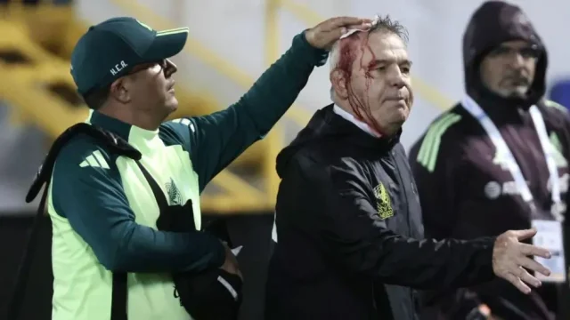 Mexican football coach injured by bottle thrown by fans